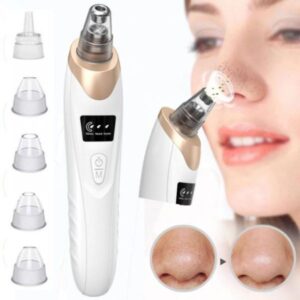Electric Blackhead Suction Remover for Deep Facial Cleansing